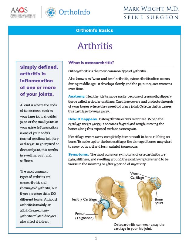 Arthritis PDF link for spine surgeon Mark Weight, MD in Idaho Falls.