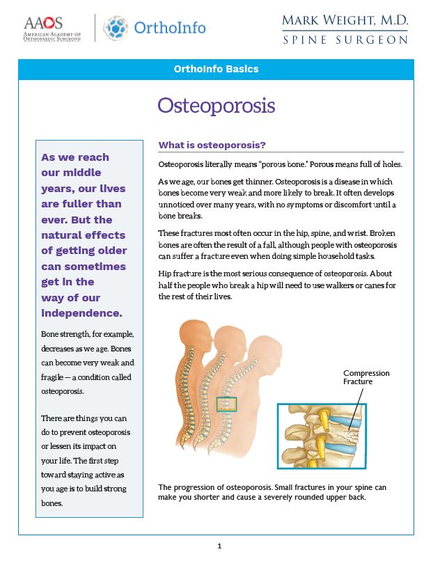Osteoporosis PDF link for spine surgeon Mark Weight, MD in Idaho Falls.